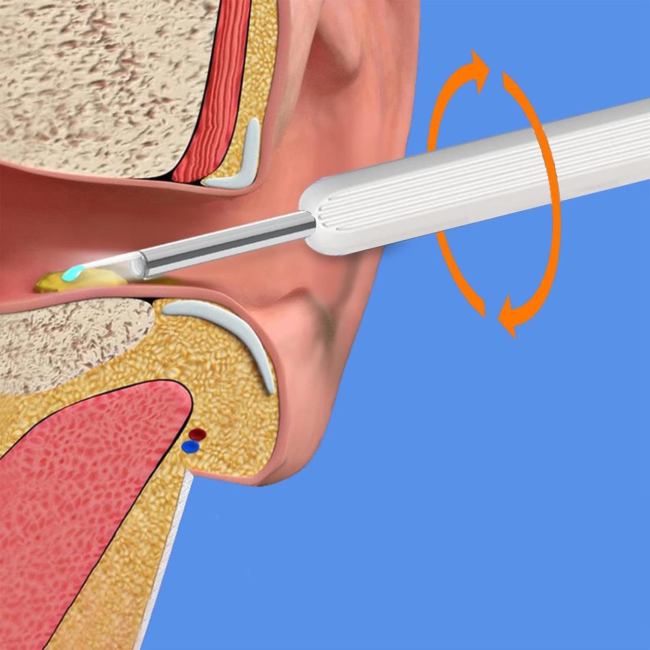 EarStick, помощник за почистване на ушна восък с камера - Image 2