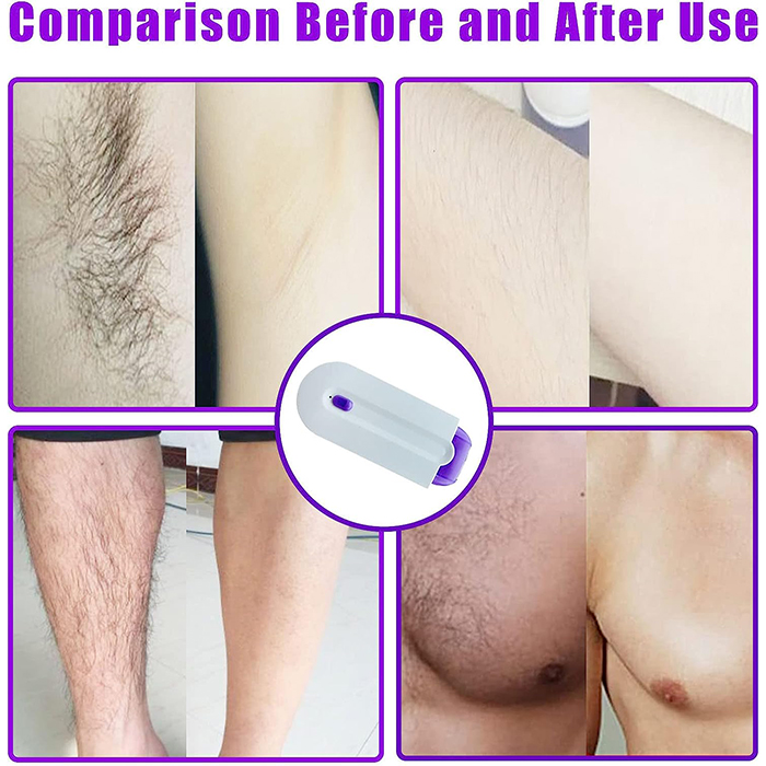 SmoothTouch, многофункционален бръснач - Image 7
